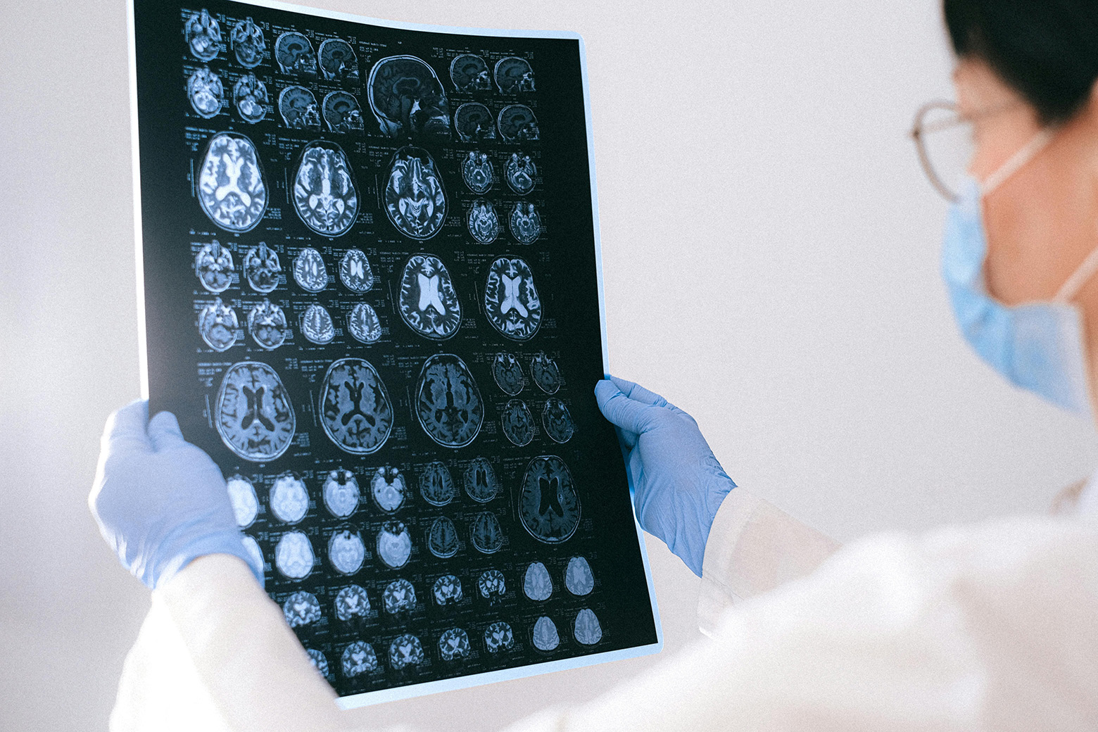 A brain image film scan being lookded at by doctor.